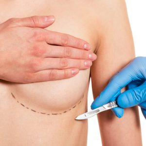 How-to-Find-the-Best-Breast-Surgeon-in-Miami