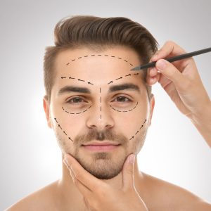 man-cosmetic-surgery